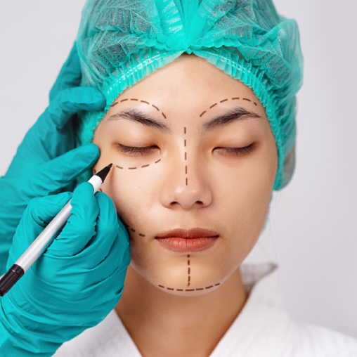 asian plastic surgery patient